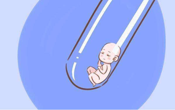 初生儿黄疸
