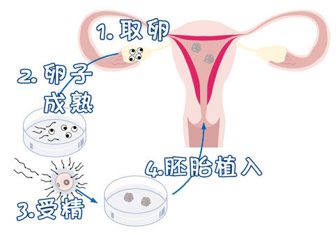 初生儿