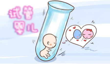妇科检查