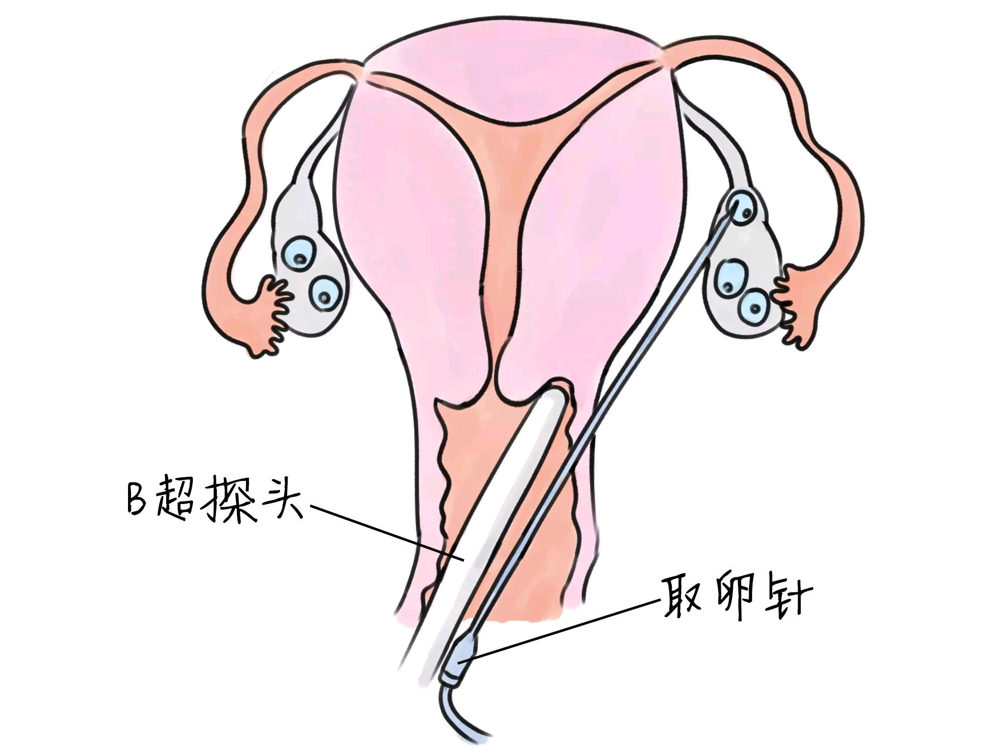 早孕抽血检查