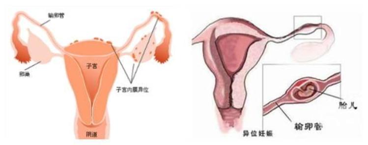 卵泡扁长