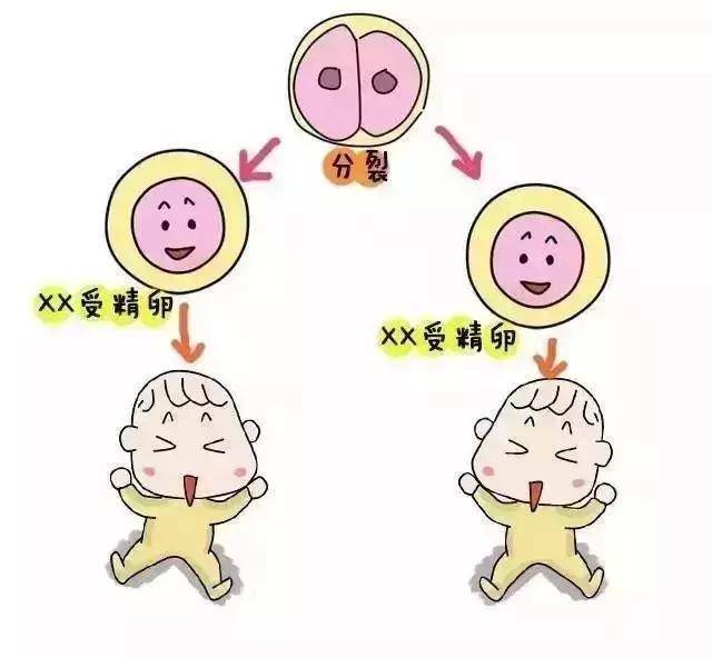新生儿黄疸