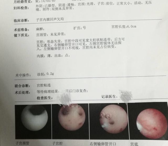 卵泡不破