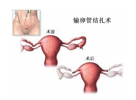 南京产假规定2021