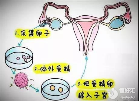卵泡数量
